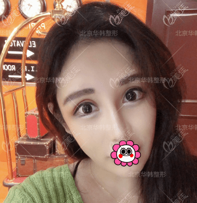 做熱拉提第8天了