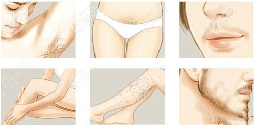 西寧時(shí)光脫毛優(yōu)惠價(jià)格表