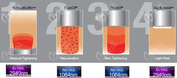 武漢藝星歐洲之星四大模式