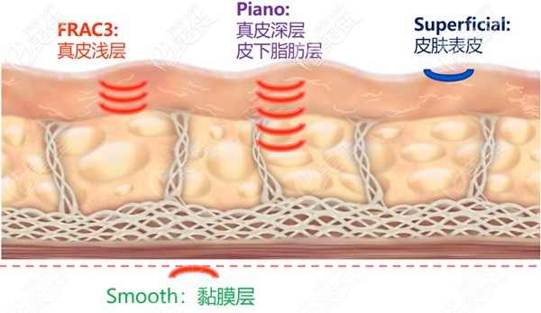 武漢藝星歐洲之星治療層次
