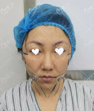 術前照片 術前照片