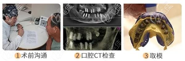 做種植牙術(shù)前準備 做種植牙術(shù)前準備