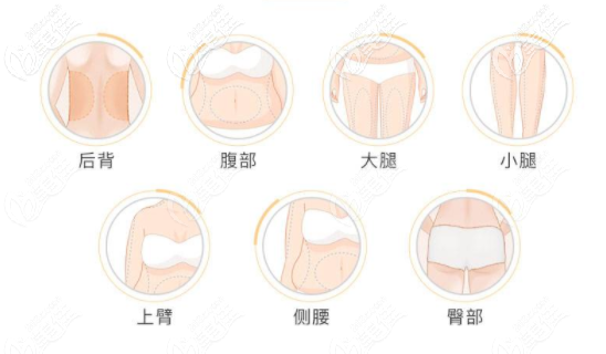深圳全身吸脂手術(shù)多少錢 深圳全身吸脂手術(shù)多少錢