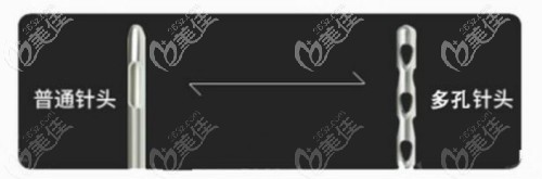 快樂吸脂和傳統(tǒng)吸脂的抽脂針頭區(qū)別 快樂吸脂和傳統(tǒng)吸脂的抽脂針頭區(qū)別
