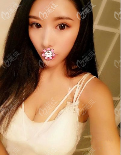 重慶美萊曼托275cc隆胸6個(gè)月照片