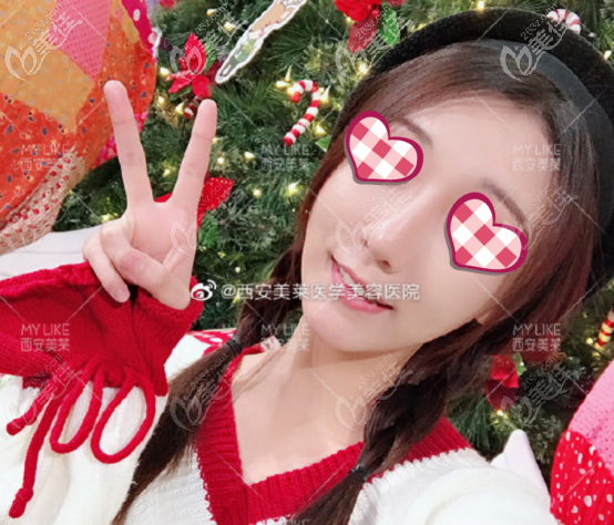 你問我西安美萊做鼻子怎么樣，我只能說高難度鼻綜合都不在話下哦