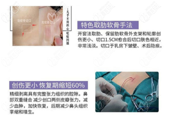 西安美萊做假體隆鼻的技術(shù)優(yōu)勢(shì)