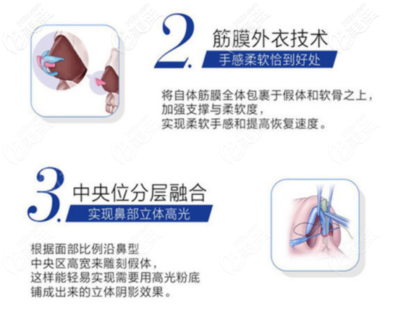 西安美萊做鼻子的技術(shù)優(yōu)勢(shì)