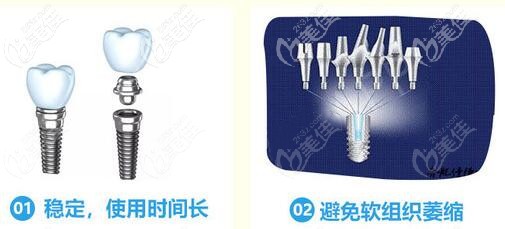 美國皓圣穩(wěn)定性好，使用壽命更長久