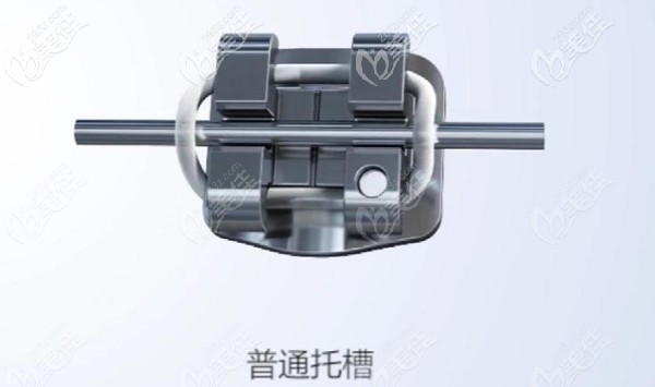 普通金屬托槽矯正