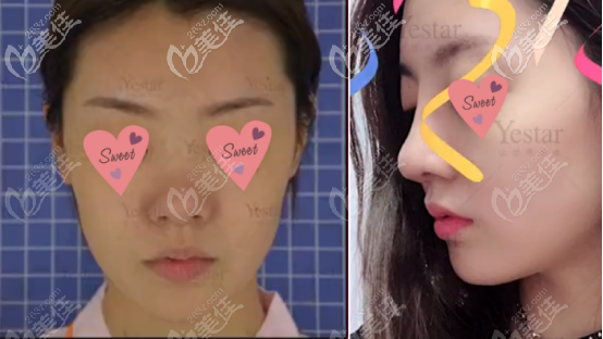 三號求美者案例圖片以及真實(shí)評價