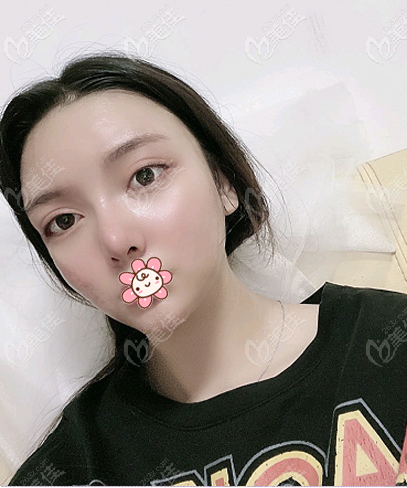 廣州下頜角手術(shù)醫(yī)生推薦<!--<i data=20240703-sp></i>--> 廣州下頜角手術(shù)醫(yī)生推薦<!--<i data=20240703-sp></i>-->