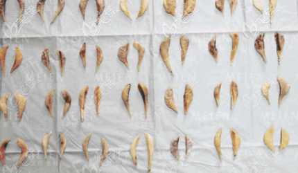 廣東美恩下頜角截骨標(biāo)本 廣東美恩下頜角截骨標(biāo)本