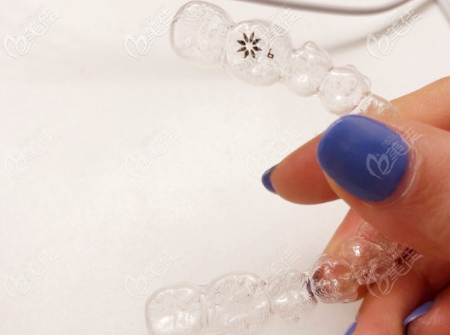 我的隱適美牙套