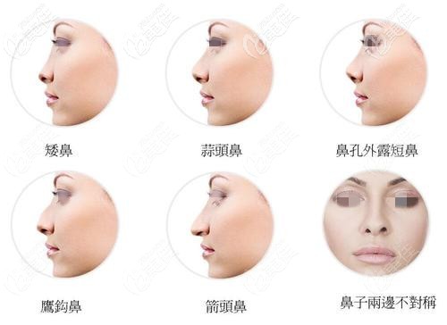 各種鼻部問(wèn)題