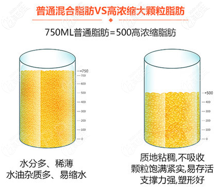 普通脂肪對比高濃縮脂肪