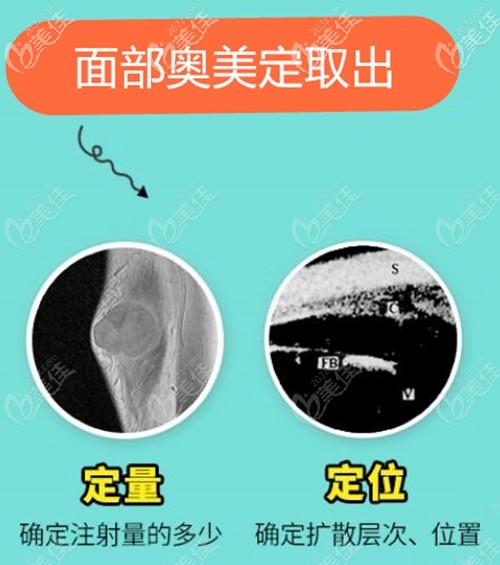 <!--<i data=20240703-sp></i>-->時光包濤院長面部奧美定取出