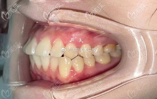 矯正前的圖片 矯正前的圖片