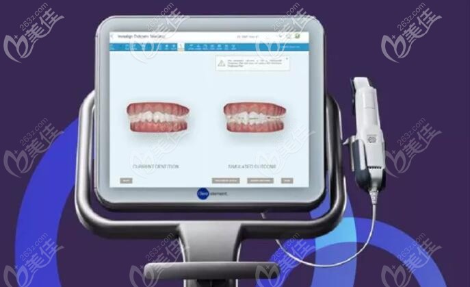隱適美itero口內(nèi)掃描儀