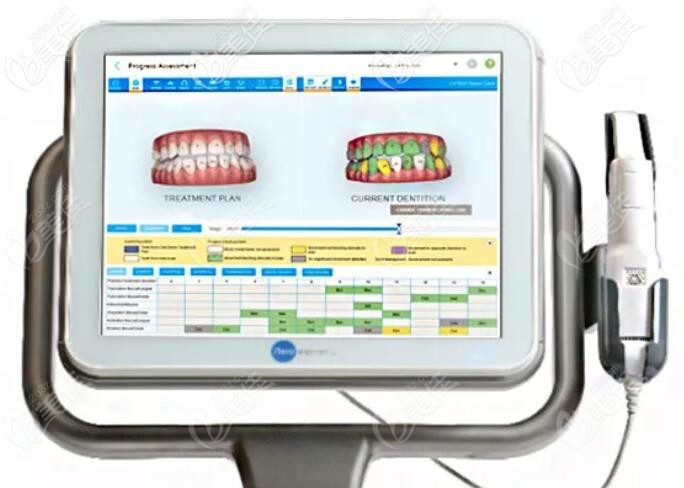 復(fù)診監(jiān)控更有效