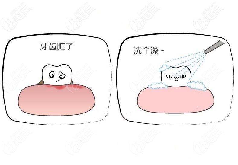 牙齒臟了就來做個(gè)超聲波洗牙