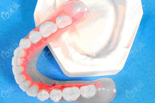 沈陽(yáng)鑲牙多少錢(qián)一顆 沈陽(yáng)鑲牙多少錢(qián)一顆