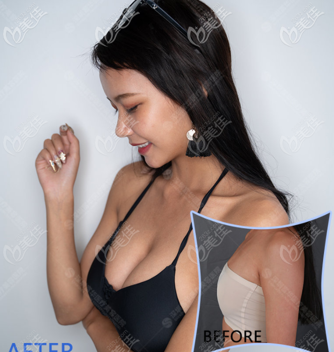 唐新輝是深圳專門做胸的醫(yī)生