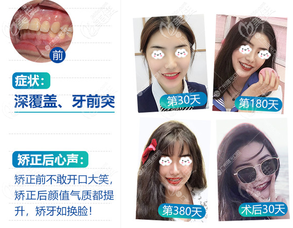 廣州曙光口腔醫(yī)院牙齒矯正怎么樣