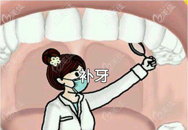 補牙的材料決定了費用