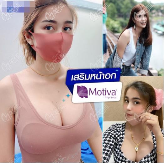 真實案例分享：泰國隆胸假體500cc效果圖