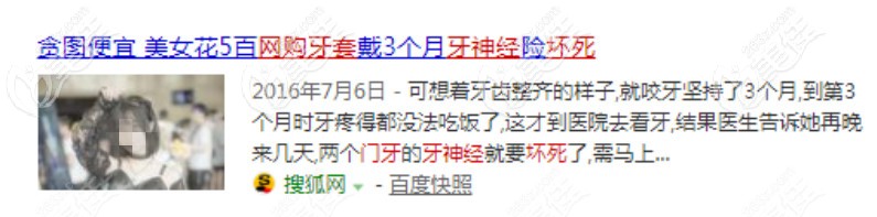 網(wǎng)上4d隱形牙套好嗎