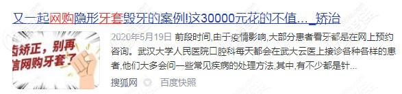 網(wǎng)購牙套怎么樣