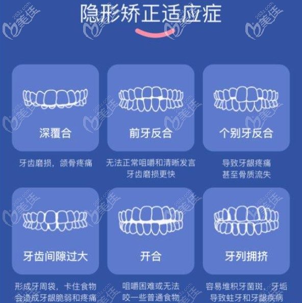 需要做牙齒矯正的適應(yīng)癥