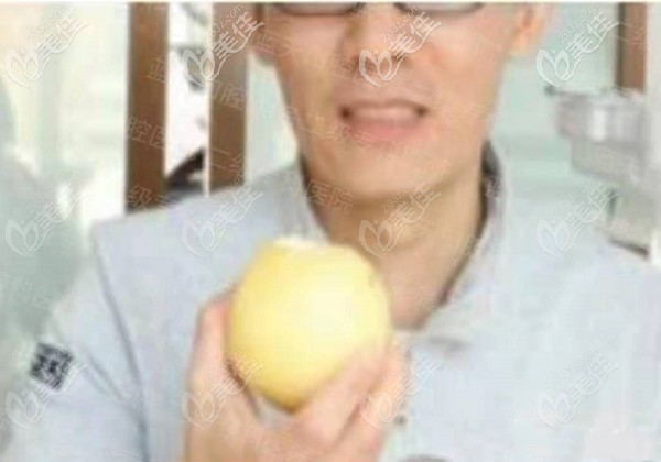 全口種植牙后的效果 全口種植牙后的效果