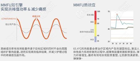 7D聚拉提MMFU技術(shù)降低痛感