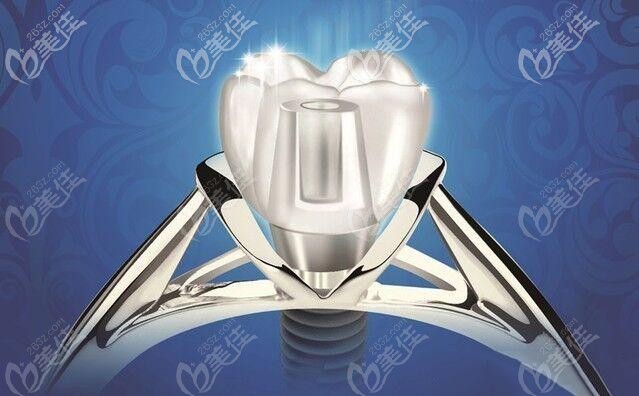 即刻種植牙的適應(yīng)癥和優(yōu)點 即刻種植牙的適應(yīng)癥和優(yōu)點