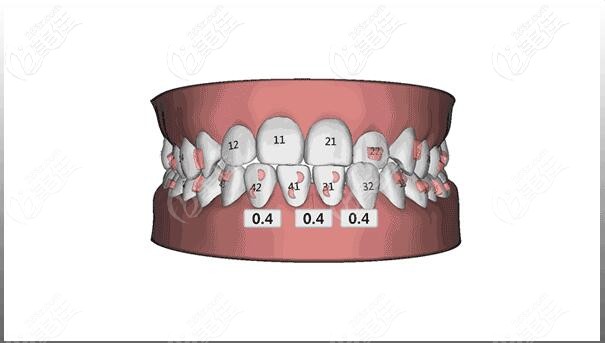 金鉑利口腔收費