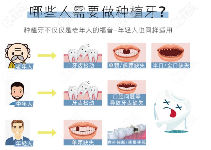 昆明美奧口腔奧齒泰種植牙