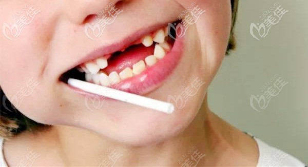 給孩子看牙要趁早