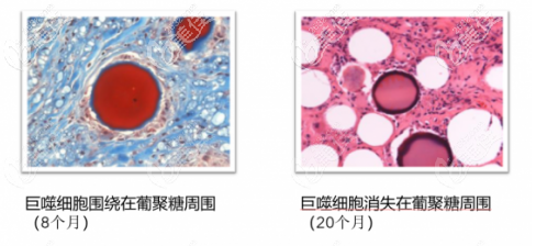 葡聚多肽細胞填充面部好不好？性怎么樣？