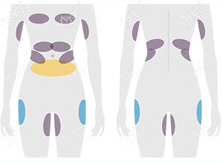北京新星靚酷塑冷凍溶脂方案?jìng)€(gè)性化