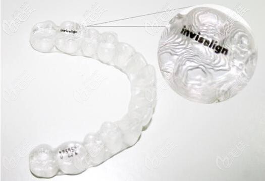 合肥隱適美牙套價格