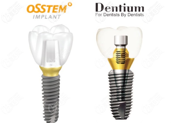 登騰和奧齒泰種植體