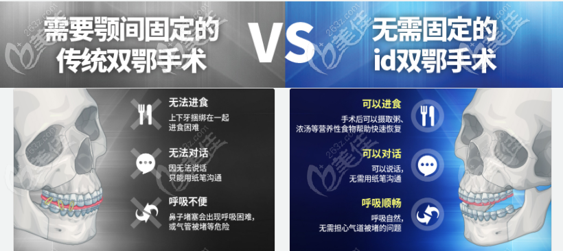 韓國(guó)雙顎手術(shù)比國(guó)內(nèi)正頜技術(shù)更先進(jìn) 韓國(guó)雙顎手術(shù)比國(guó)內(nèi)正頜技術(shù)更先進(jìn)