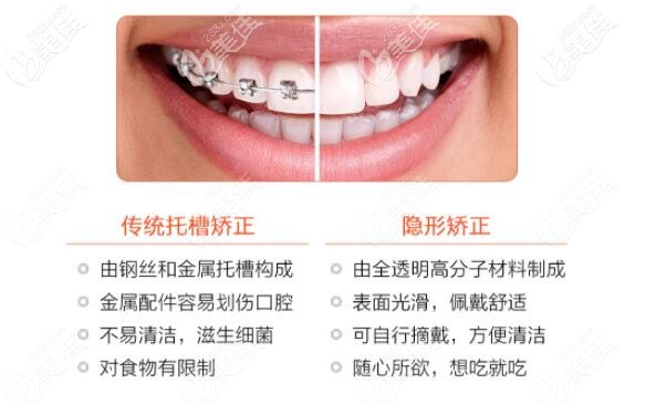 這是傳統(tǒng)矯正和隱形矯正對(duì)比