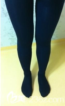 吸脂瘦大腿之后