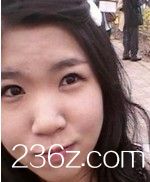 自體脂肪移植豐額頭