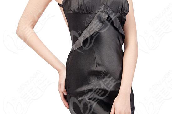 臉部自體脂肪移植