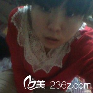 注射瘦臉除皺瘦臉