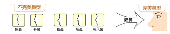 全盤解析隆鼻手術(shù) 讓隆鼻不再迷霧重重